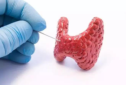 甲状腺疾。鬃聪俟δ芗跬撕图鬃聪俟δ芸航，自古以来就是反复被医学研究人员研究的疾病