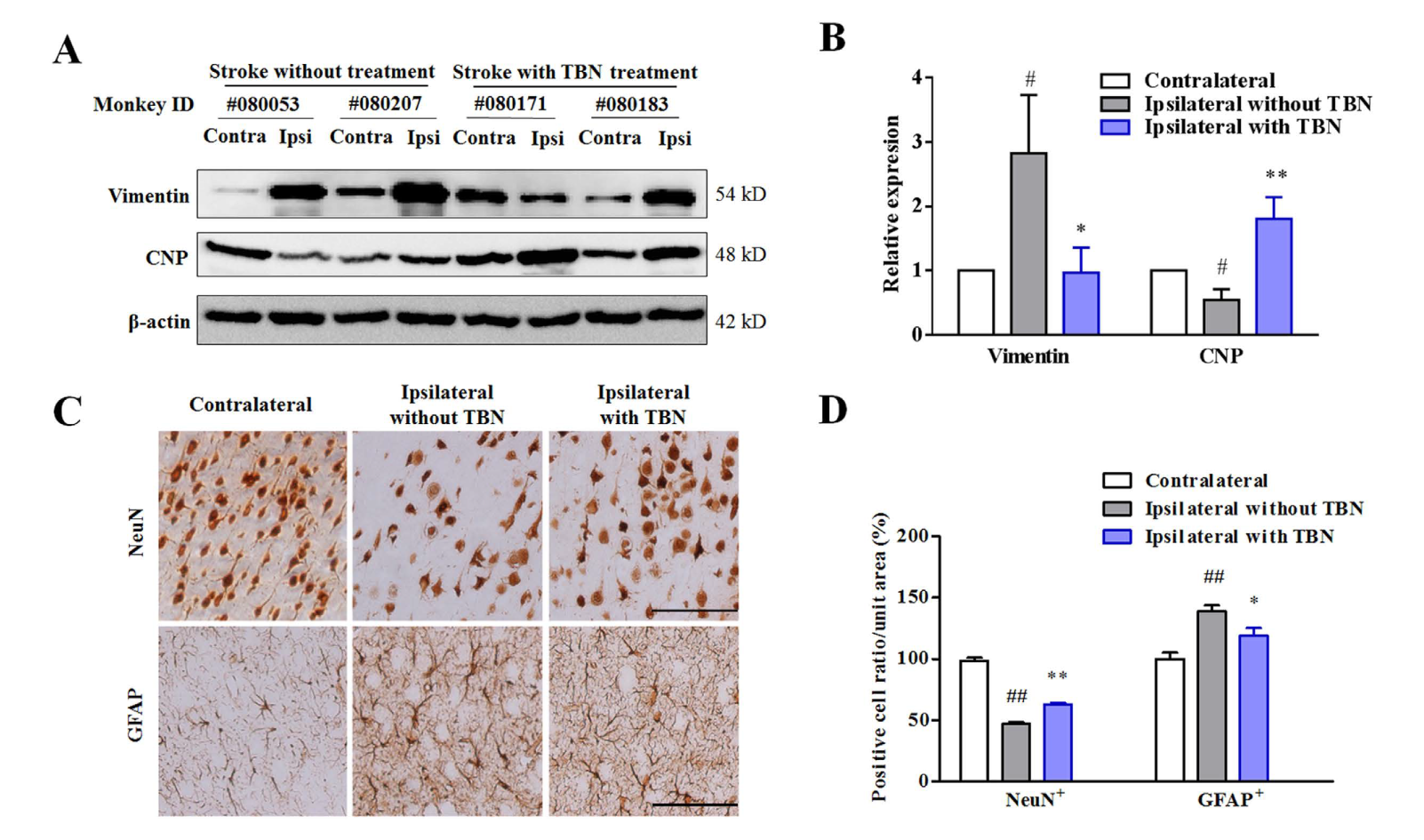 TBN是一种治疗缺血性卒中的新型临床候选药物，本研究中TBN通过HJC黄金城平台合成